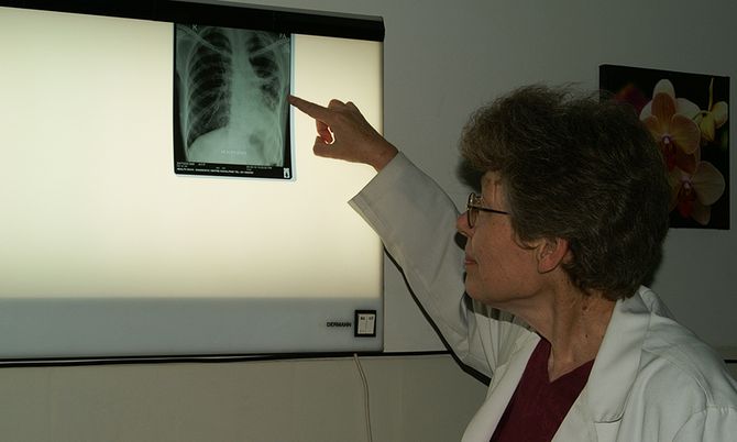Dr. Chris Schmotzer untersucht eine Röntgenaufnahme eines Tuberkulosepatienten.